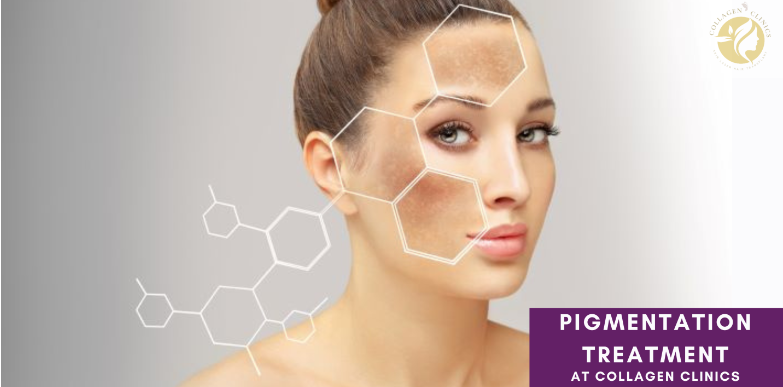 ALL YOU NEED TO KNOW ABOUT PIGMENTATION