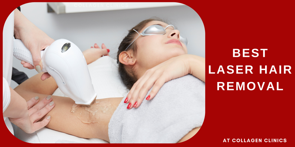 Laser Hair Removal Collagen Clinic Best Skin and Hair Clinic