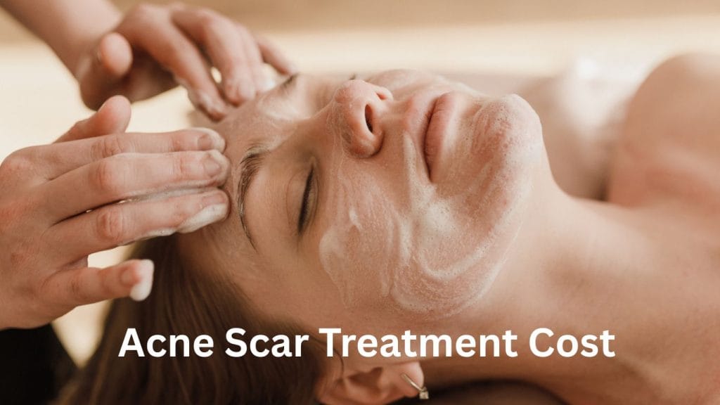 acne scar treatment cost in jaipur at collagen clinics