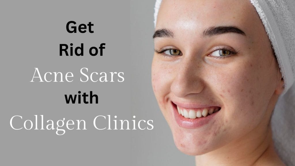 acne scar treatment in jaipur