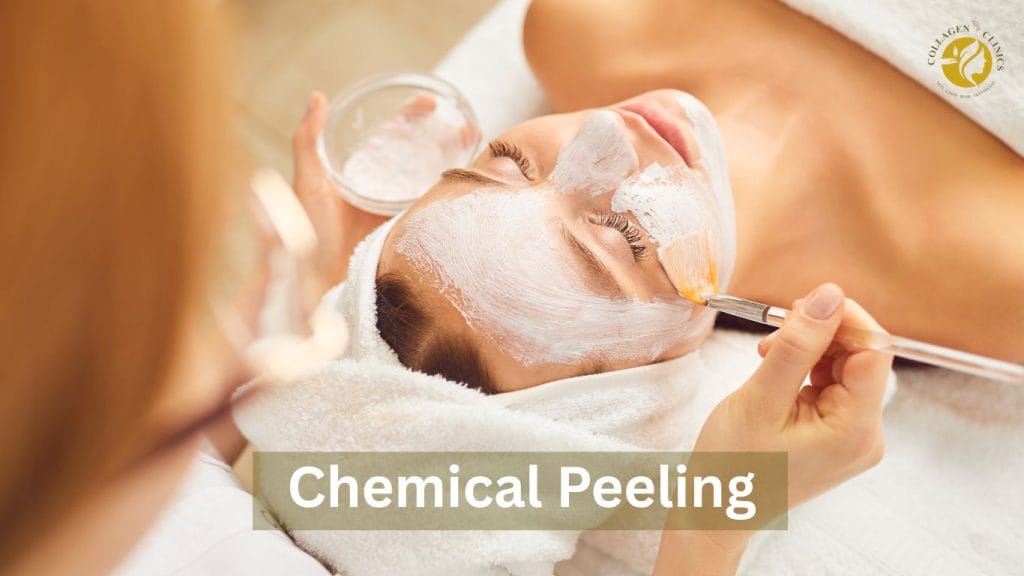 Chemical peeling in jaipur collagen clinics