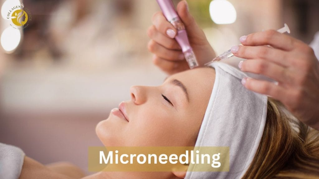 microneedling treatment in jaipur at collagen clinics