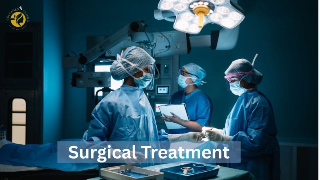 surgical acne scar treatment in jaipur