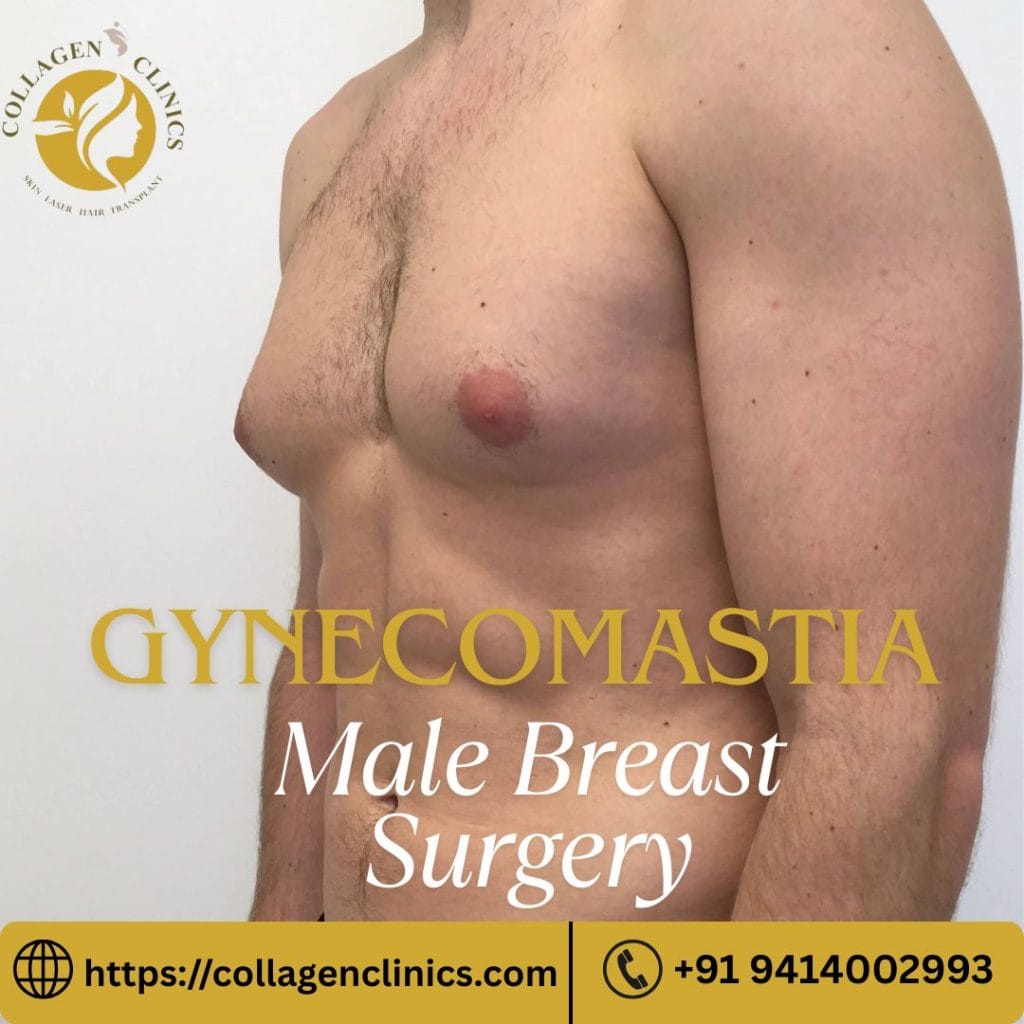 Gynecomastia Male Breast Surgery in Jaipur