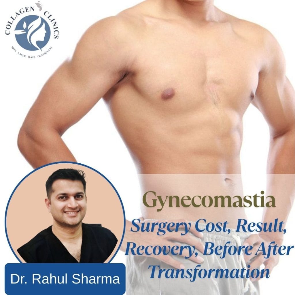 gyno before after results in jaipur