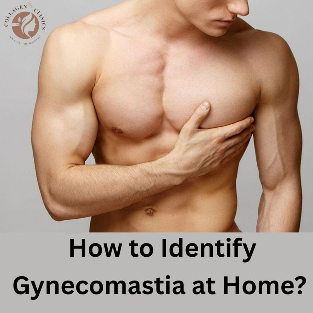 How to Identify Gynecomastia at Home?
