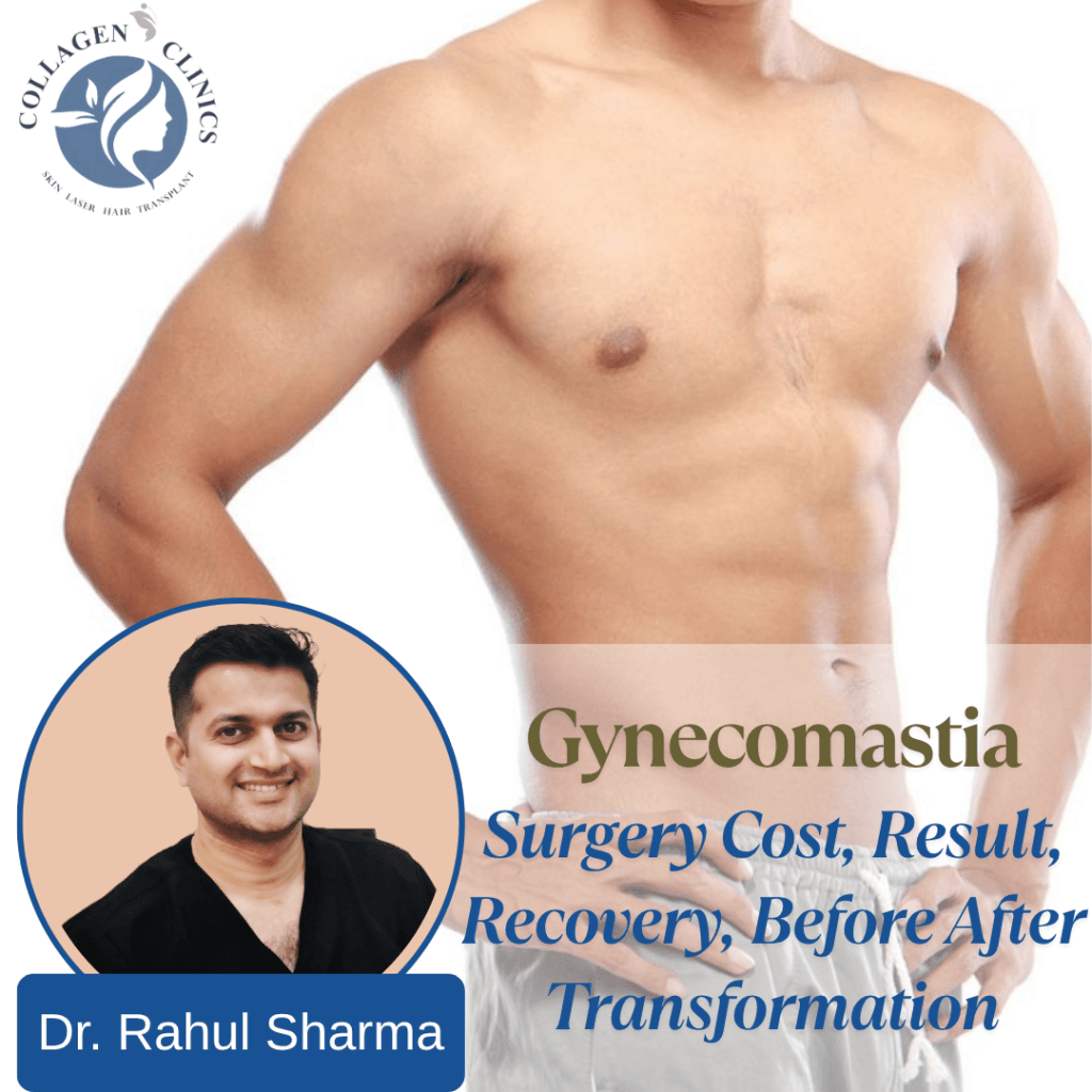 Gynecomastia Treatment in Jaipur